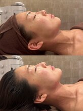 パルティール 渋谷店 partir/ゾーガンメソッドでここまで！