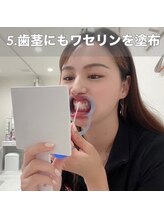 ホワイトニングショップ 日進店/5歯茎にワセリン塗布　日進