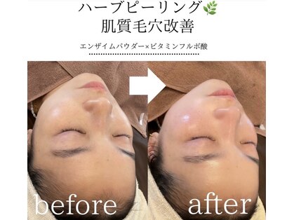 ナルシス(Narcissus)の写真