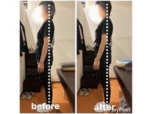 カワル整体 上通り院/反り腰の人の特徴