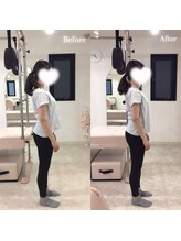 ピケピラティス 門前仲町店(pique pilates)/反り腰改善