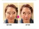 コティニー(cottiny)の写真