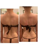 エステティックサロン エリゼ(ELISE)&nbsp;骨きわ削り で叶う痩身