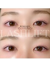 アンリー 栄店(UNLY)/ウルウルeye