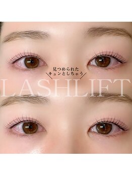 アンリー 栄店(UNLY)/ウルウルeye