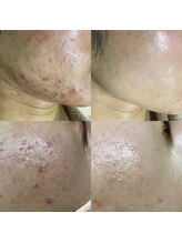 エヌエー(na)/揺らがないお肌を育てていく。