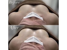 ブレスト サロン 奈良店(Bryst Salon)/バストアップ症例