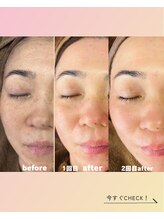 ナナラ(nanara)/マリムーブフェイシャルワックス