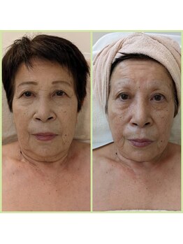 ポーラ ザ ビューティ アピタ千代田橋店(POLA THE BEAUTY)/劇的