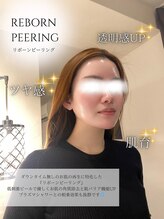 ブリリオプラス 四条烏丸店(Brillio plus)/REBORNピーリング