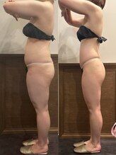 パリスヒロトン(PARIS HIROTON)/-15kg達成のお客様(30代)