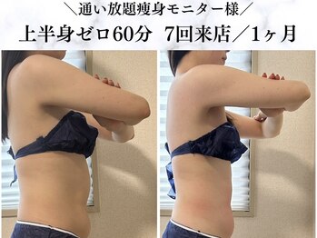 シーフェイス 横浜店(SEE FACE)/上半身ゼロダイエットモニター様