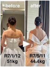 ハッチー(Hacchi)/【20代】ブライダル痩身！