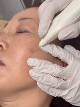 グラチア(Gratiae)