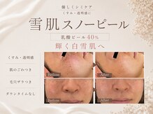 ルミラポー(Lumira Peau)