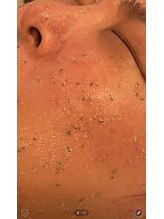 凪 横浜/不要角質を取り肌の呼吸を助ける