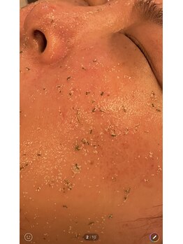 凪 横浜/不要角質を取り肌の呼吸を助ける