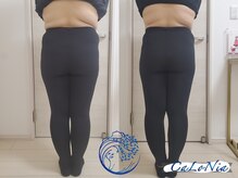 カロニア(CaLoNia)/骨盤子宮ケア