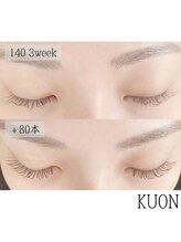 クオン(KUON)