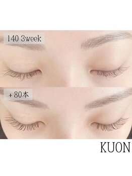 クオン(KUON)の写真/ベテランスタッフがまつ毛の状態を見極め、お悩みに合わせて施術いたします♪高技術×高品質でモチの良さ◎