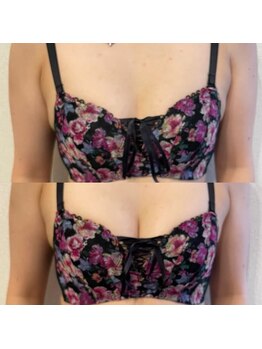 ハル 水戸市(HaRu)/バストメニューも◎