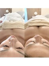 ふわりん/バスト専門でなくてもこの結果