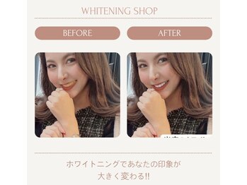 ホワイトニングショップ 川越店/【白い歯で印象UP】