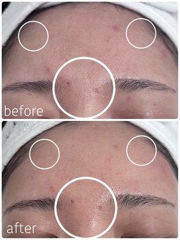 グレイス アンド ミューズ(grace&muse)/産毛waxうるすべ肌実感コース