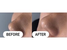 ベルミーランド 遠鉄ストア見付/