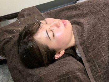 カンワ美容鍼灸院(KANWA美容鍼灸院)の写真/電気鍼で血行促進後に鍼をさし,お灸をするので普通のお灸よりも効果◎【頭痛撃退/眼精疲労改善】メニュー有