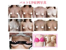 エトワールの雰囲気（何歳からでも遅くない！授乳後のしょんぼりバストもハリ復活♪）