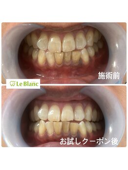 ルブラン 奈良店(Le Blanc)/お試し3回クーポン