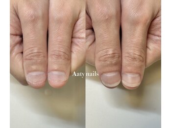 当日から見た目改善