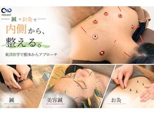 むげん整骨院鍼灸院 近江八幡の雰囲気（頭痛・不眠・慢性的なだるさといった自律神経由来の不調に鍼灸）