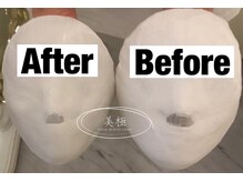 美極 トータルビューティー(美極 TOTAL BEAUTY)/恵比寿/小顔コルギ/エステ/