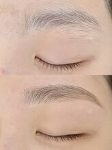 エムシー葵(MC葵)/アイブロウWax脱毛