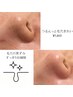 夏得割【鼻の黒ずみ、ザラつきが気になる方】つるんっと毛穴きれい¥5,800