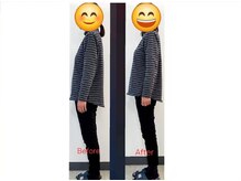 首肩調整・骨盤調整後ビフォーアフター