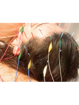 ホウレイ線・たるみ改善！予防ケア