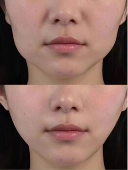 シホン 博多(SHIHON)/