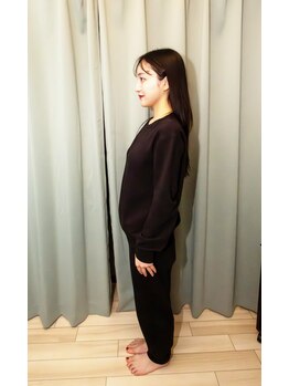 鍼灸マッサージ院 アルフィーネ(alfine)/施術後評価（前後の変化確認）