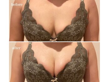 プリマベラ 花隈店(Primabella)/バストアップ☆ビフォーアフター