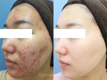 フェイシャル専門店 エピア 掛川店(Epia)