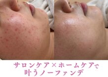 ミュー 金山店(mieux)