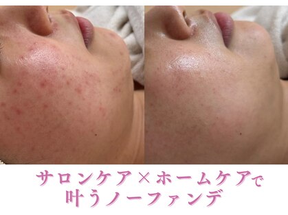 ミュー 金山店(mieux)の写真