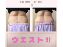 スリム(SLIM by lily of the valley)の雰囲気（どこよりも安くて早い結果！大人気の脂肪冷却とEMS併用が◎）
