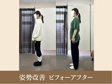 オリエンタル整体院 新潟院/20代 販売 姿勢改善成果