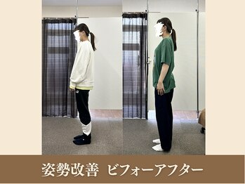 オリエンタル整体院 新潟院/20代 販売 姿勢改善成果