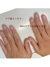 エクラプラス(Eclat.plus)/1回のケアでもスッキリ