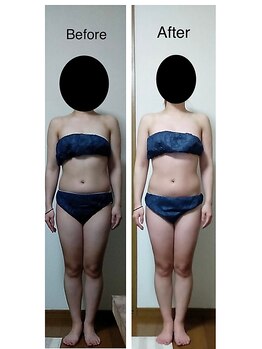 ナチュラルライフ(Natural Life)/施術のbefore after